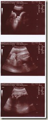 Ultrasound1-39weeks
