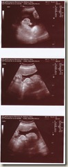 Ultrasound2-39weeks